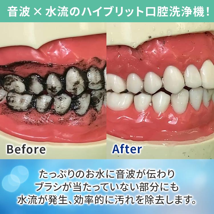 LEソニックウォッシュ｜テレ東マート