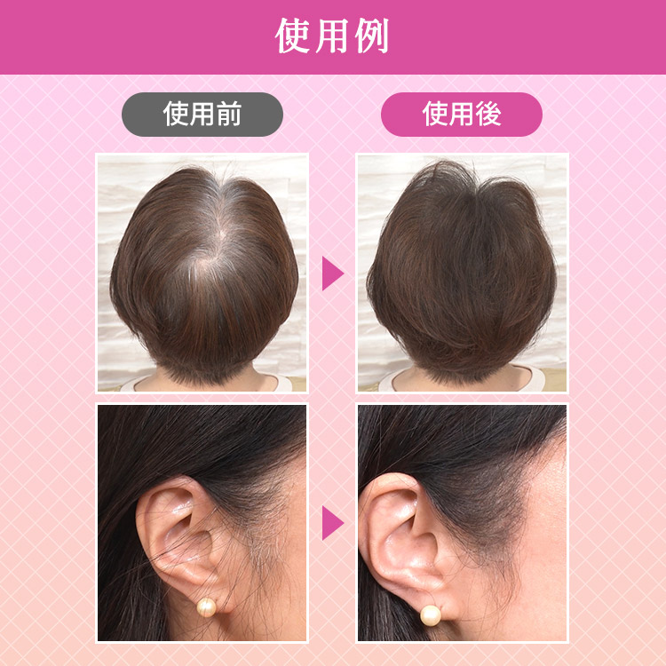 アートミクロンモアモアプラス 特別セット｜テレ東マート